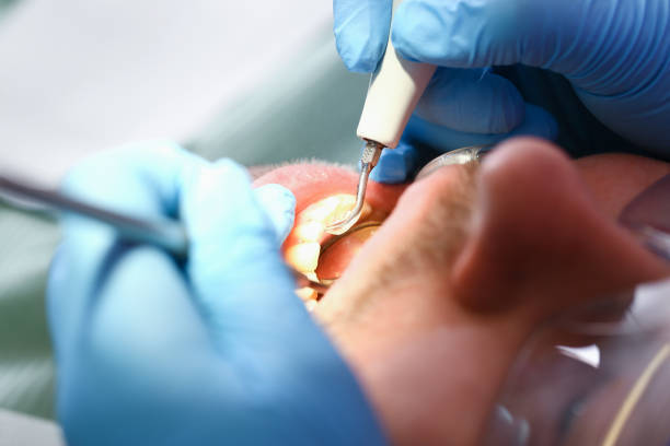 Best Pediatric Emergency Dentist in Wrightsville Beach, NC
