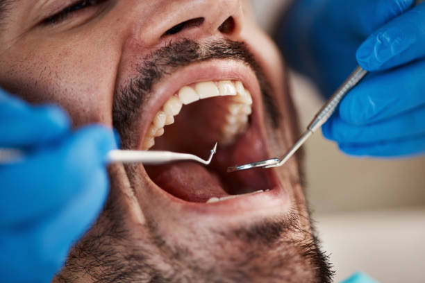 Best Broken or Cracked Tooth Emergency Dentist in Wrightsville Beach, NC